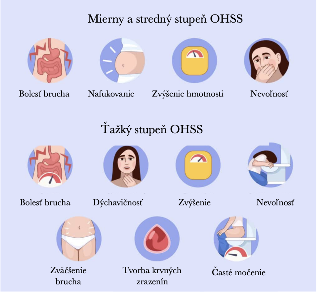 Infografika syndrómu ovariálnej hyperstimulácie (OHSS) zobrazujúca zväčšené vaječníky, brušný opuch a príznaky ako bolesť brucha, nevoľnosť a tvorba krvných zrazenín.